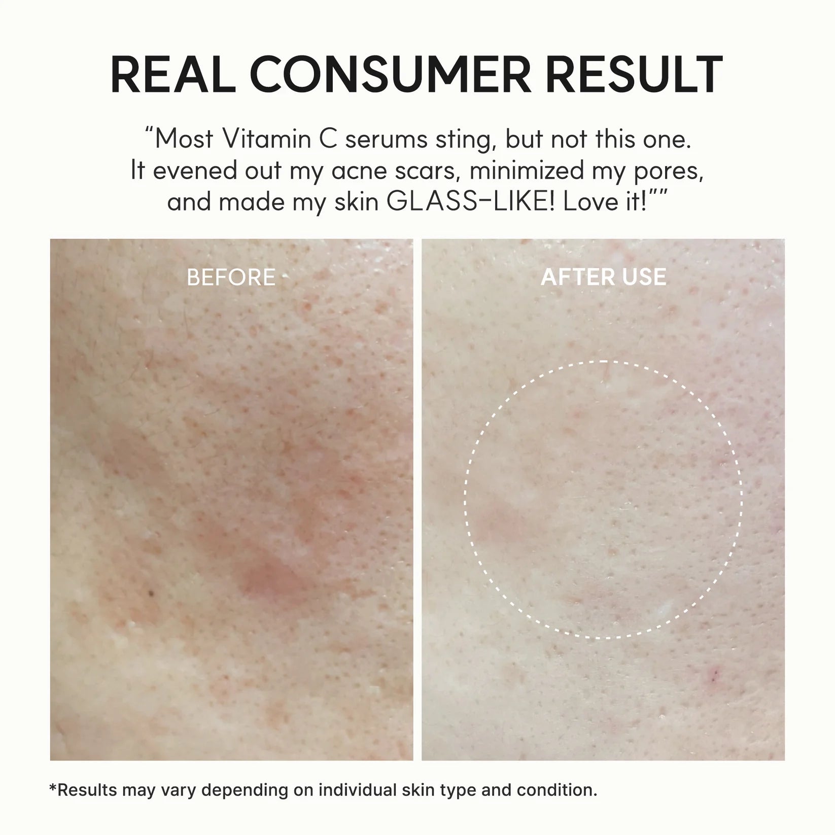 Vitamin C Booster Shot Face & Eye Cream Moisturizer — Pure Vitamin C & Glutathione for Bright Skin
