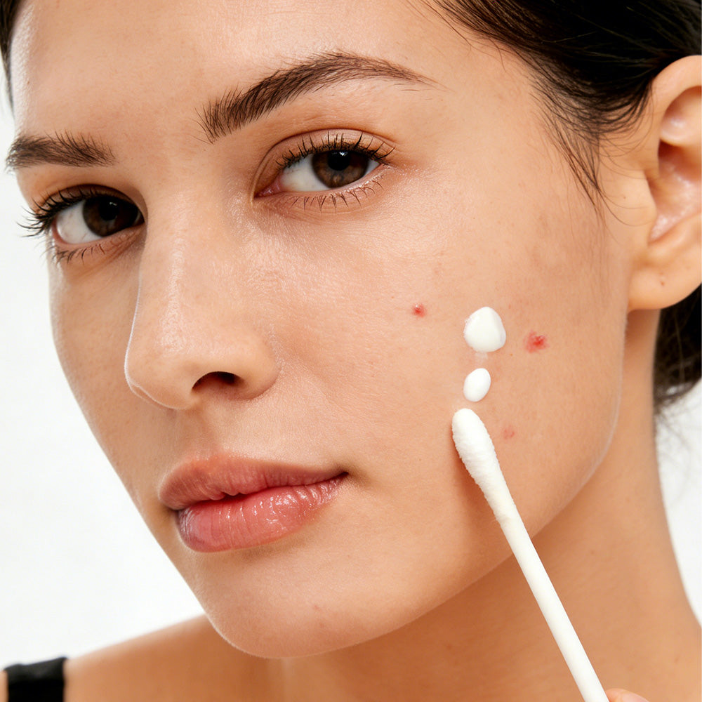 Clear Skin Salicylic Acid Drying Lotion with Niacinamide, Sulfur & Zinc Oxide – Spot Treatment 20mL