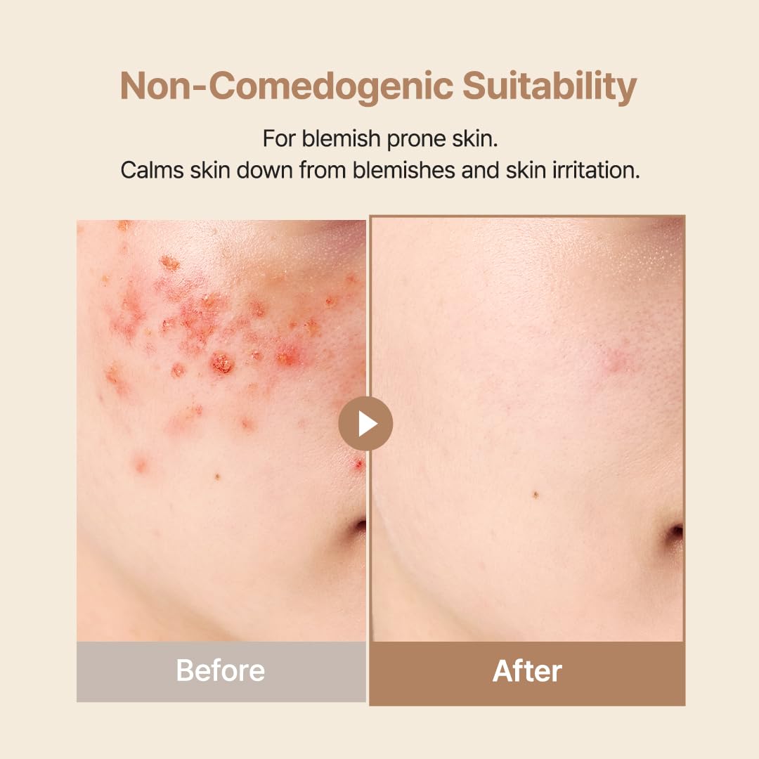 Oat In Calming Gel Cream Water-Gel Face Moisturizer, Sensitive & Blemish-Prone Skin