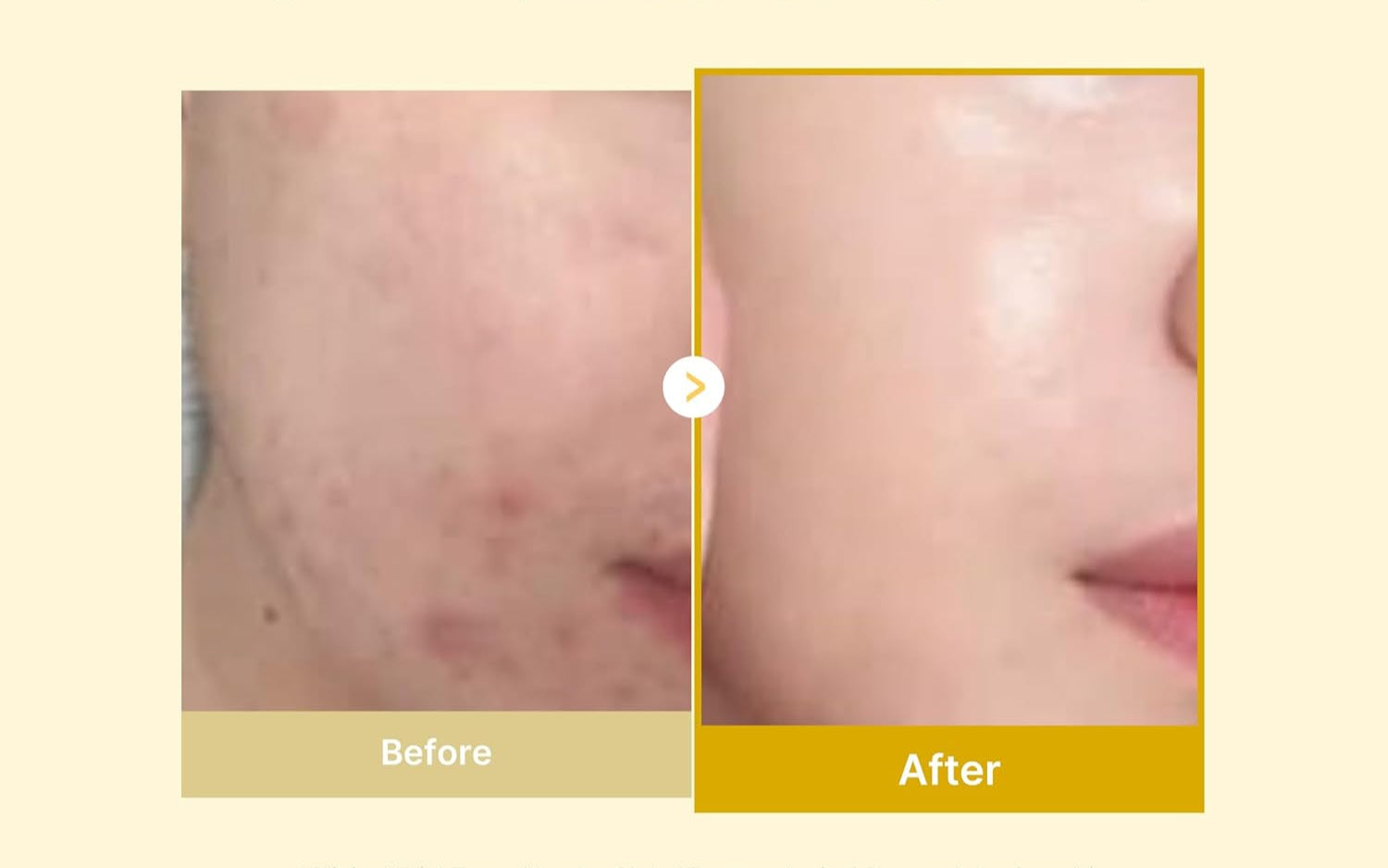 Kojic Acid Turmeric Night Wrapping Mask — Korean Skincare, 75mL