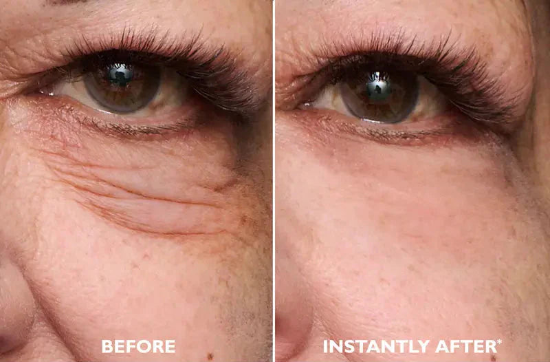 Instant FIRMx Eye Temporary Eye Tightener for Puffiness, Fine Lines & Crow's Feet