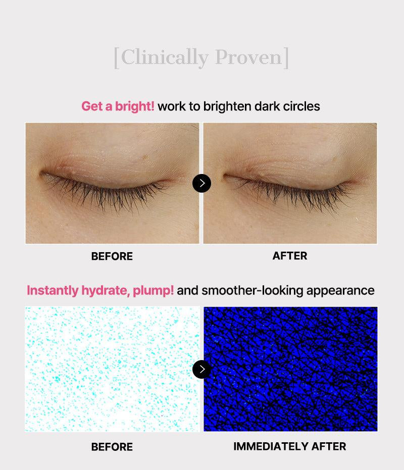 The Peptide Collagen Hydrogel Eye Patch for Dark Circles, Puffy Eyes & Fine Lines