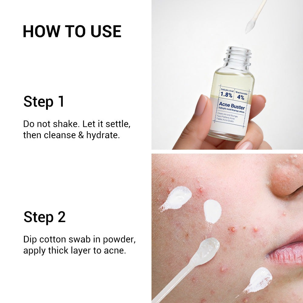 Clear Skin Salicylic Acid Drying Lotion with Niacinamide, Sulfur & Zinc Oxide – Spot Treatment 20mL