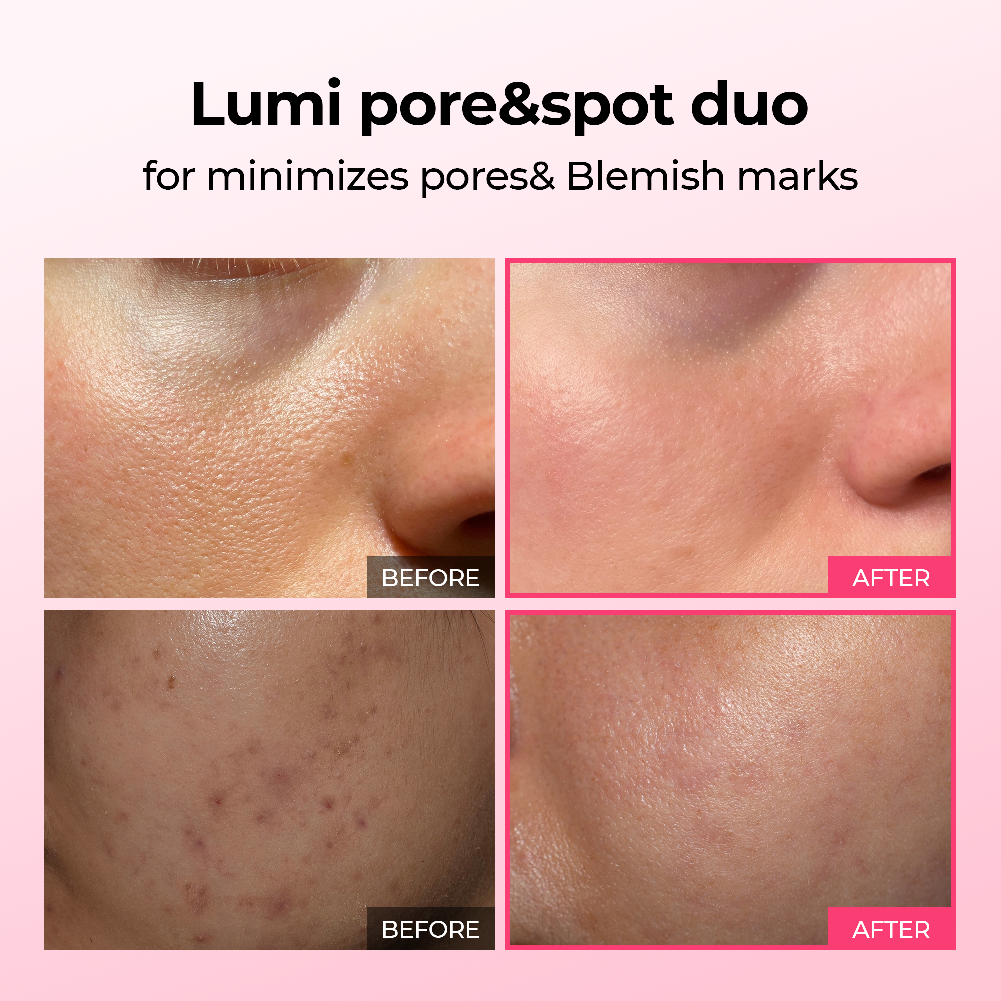 Lumi Pore & Spot Care Serum Duo for Clearer, Brighter Skin