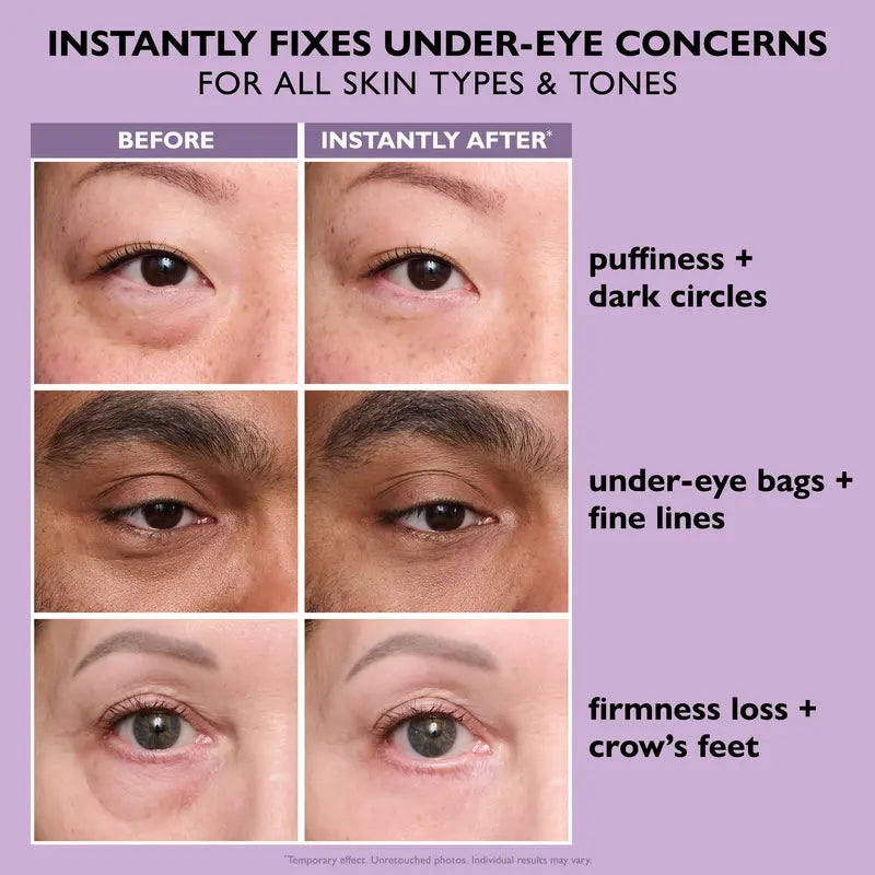 Instant FIRMx Eye Temporary Eye Tightener for Puffiness, Fine Lines & Crow's Feet