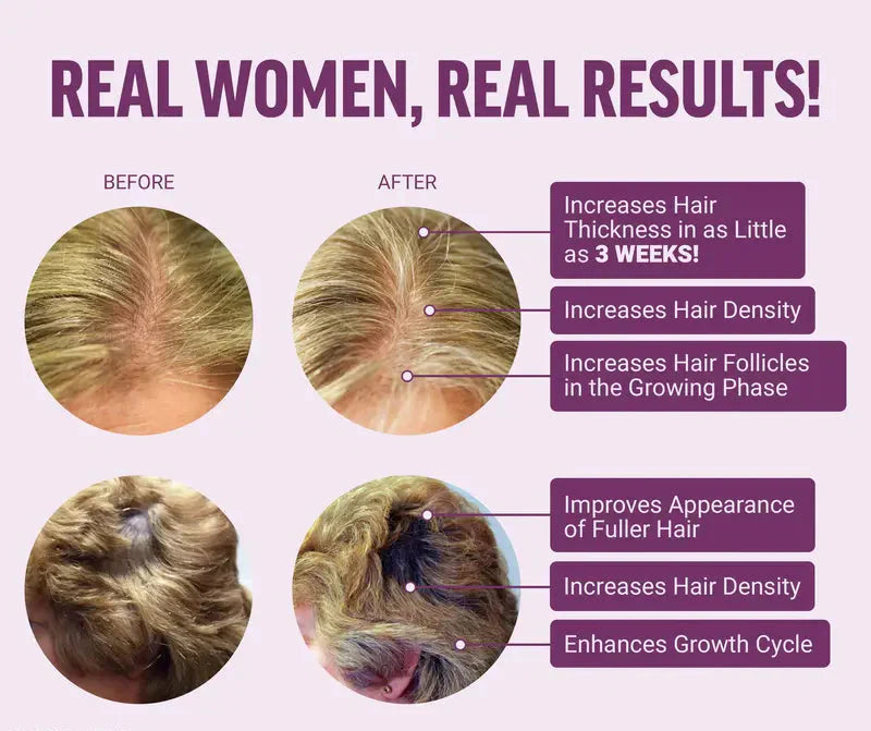 Hair Growth Accelerator Biotin Supplement Capsules & Soft Chews